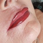 lip with filler