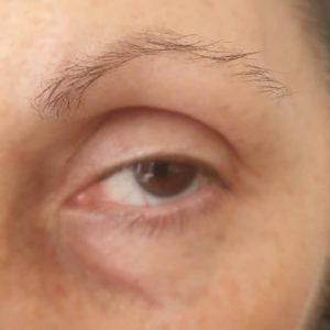 eyebrow tattoo before 4