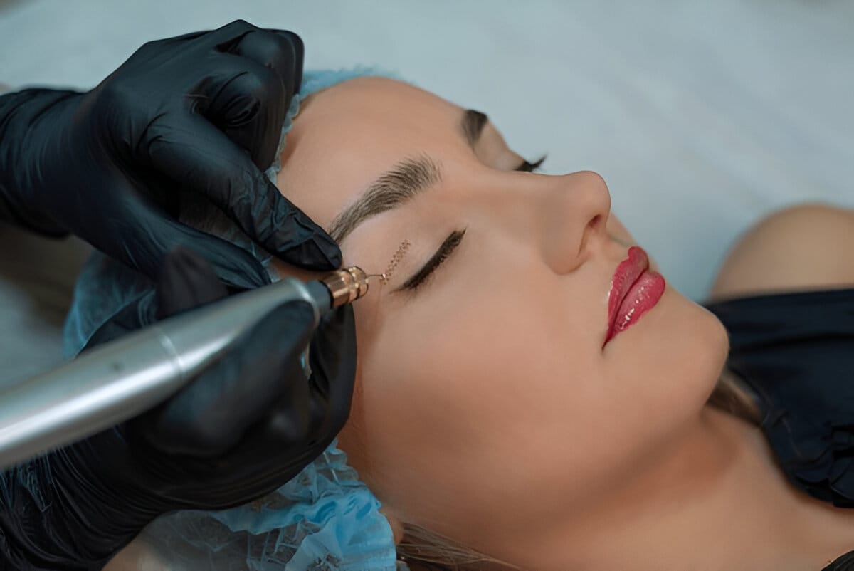 fibroblasting-recovery-timeline-img fibroblasting-recovery-timeline-img