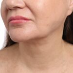 why-hifu-results-vary - img (2)