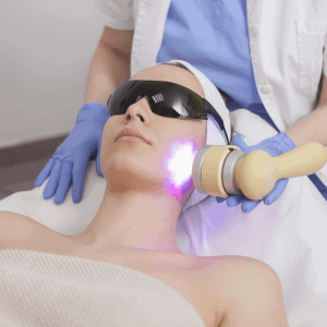 IPL-intensepulselight IPL Treatment