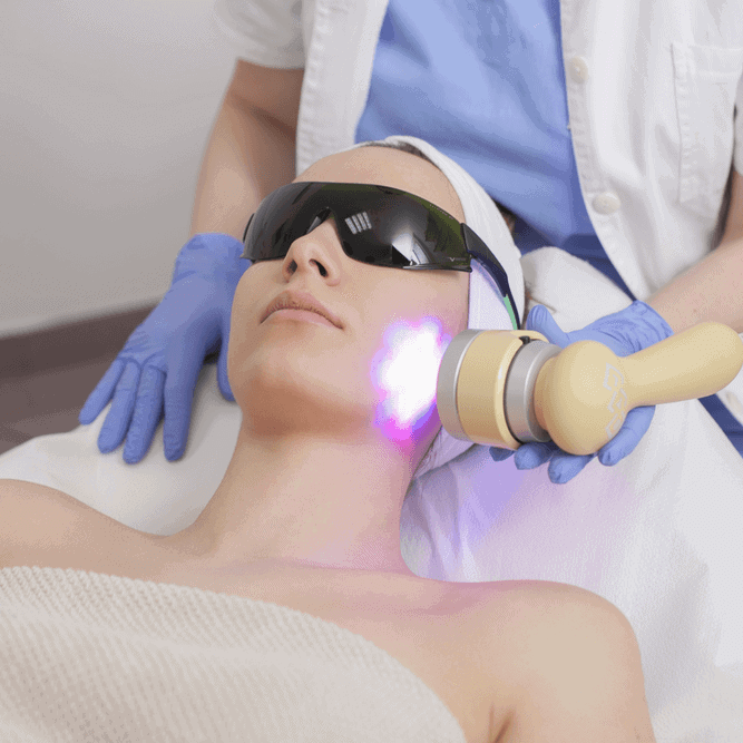 IPL-intensepulselight IPL Treatment