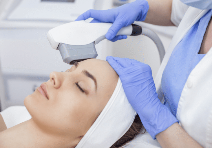 IPL Treatment IPL Treatment