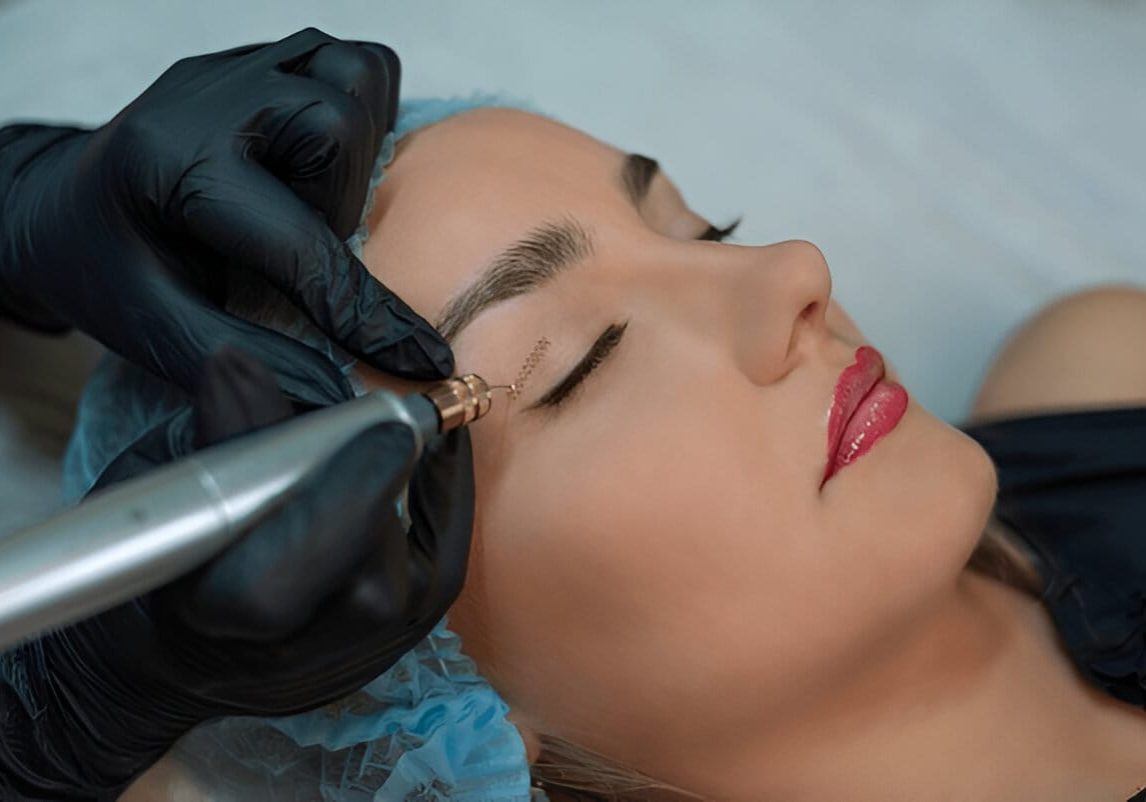 fibroblasting-recovery-timeline-img fibroblasting-recovery-timeline-img
