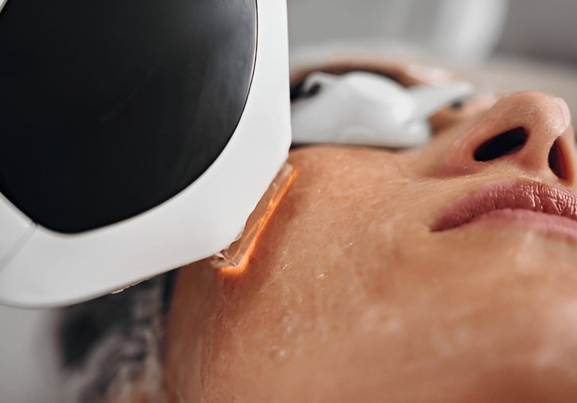 ipl-treatment-what-to-expect-image (3) ipl-treatment-what-to-expect-image (3)