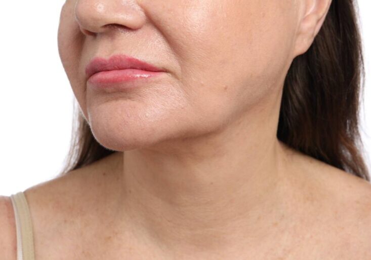 why-hifu-results-vary - img (2)
