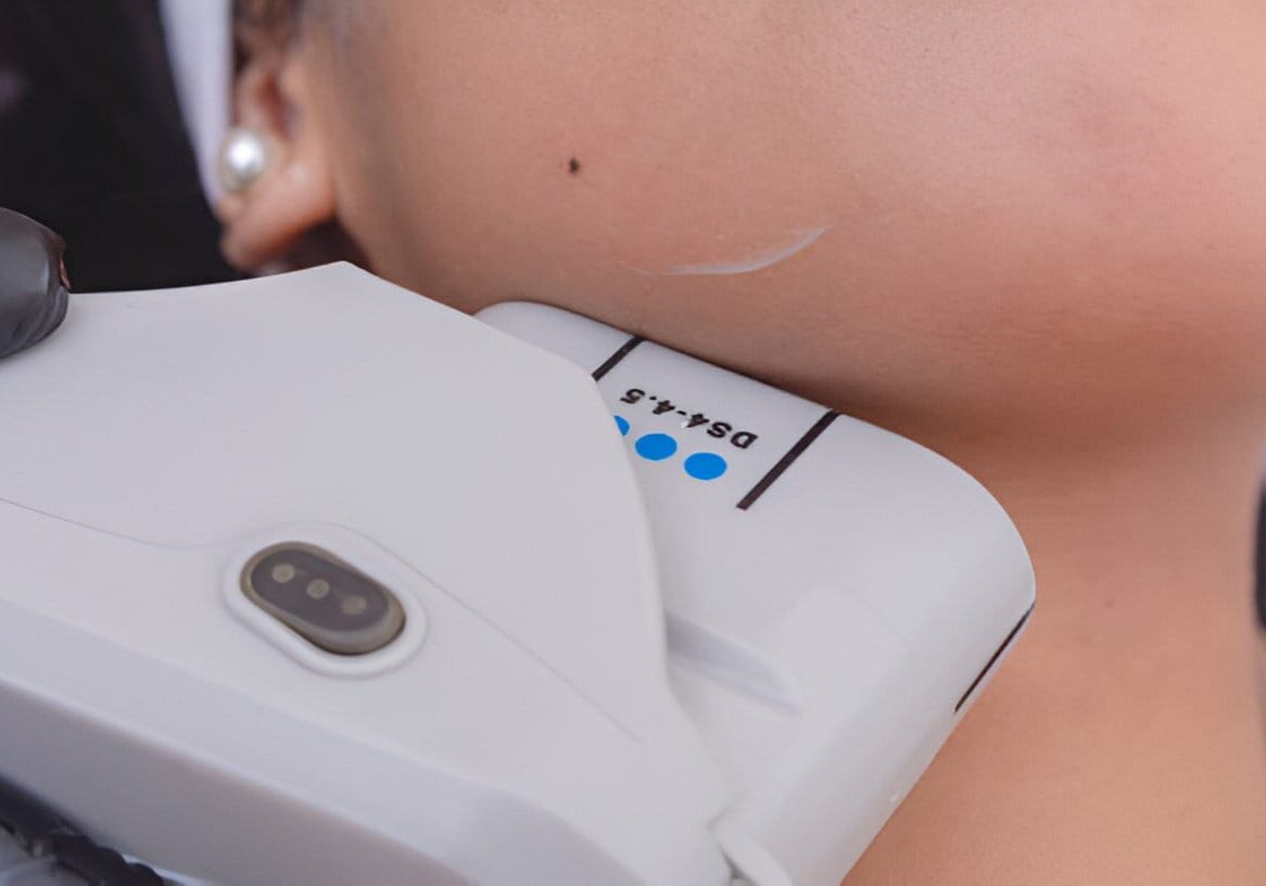 your-complete-guide-to-hifu-treatment-results-and-recovery-image (2)